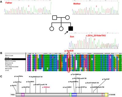 Clinical and genetic features of luscan-lumish syndrome associated with a novel de novo variant of SETD2 gene: Case report and literature review